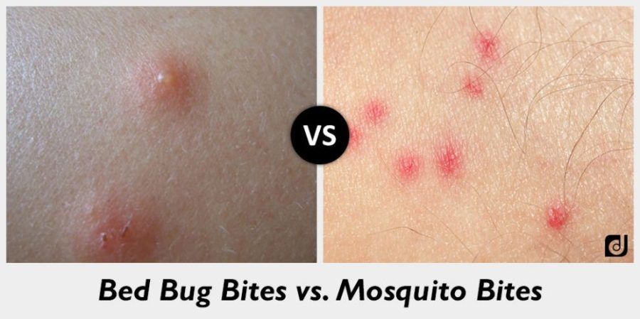bed-bug-bites-vs-mosquito-bites-990x495.jpg